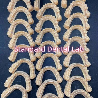 Professional Dental Teeth Orthodontic Invisalign Clear Retainers Treatment Plan