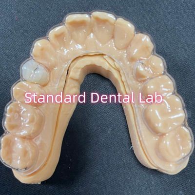 Professional Orthodontic Retainer Clear Essix Retainers With Stable Acrylic Resin Teeth