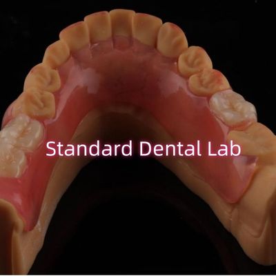 High Esthetic Flexible Valplast Partial Denture Easy To Clean
