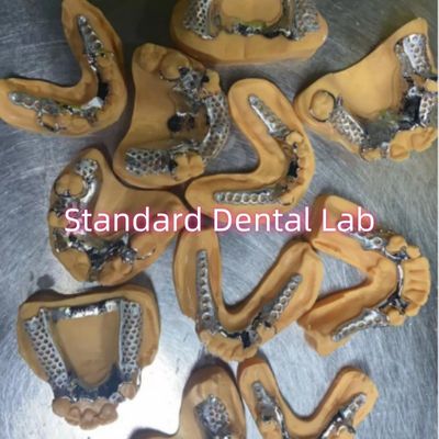 Removable Cobalt Chrome Cast Metal Framework Partial Dentures