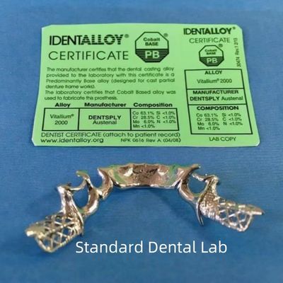 MetalVitallium Partial Denture Nickel And Beryllium Free Chrome Cobalt Alloy