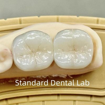 Dental Lab Crowns Translucent Full Contour Zirconia With Superior Strength