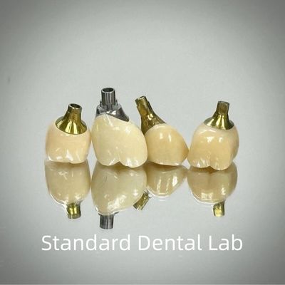 Professional Zirconia Screw Retained Implant Crown Titanium CAD CAM