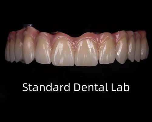 Titanium Full Zirconia Bridge Dental Translucency On Implant Bar