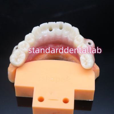 Biocompatible Tooth Colored Zirconia Dental Implant Bridge