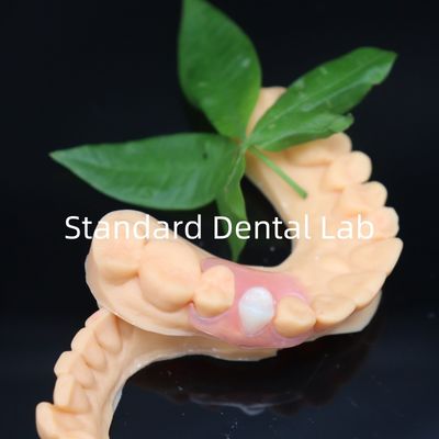Esthetic Valplast Flexible Dentures with Free Redo Policy in 3 Days China Dental Lab