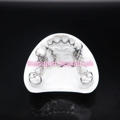 Printed Scheftner Metal Partial Denture Framework Accurate Customized Cast Partial Denture