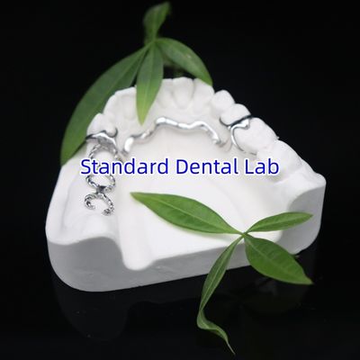 Vitallium 2000 Partial Framework ISO CE And FDA China Dental Lab Metal Framewrok Partial Denture