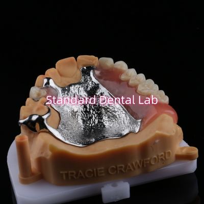 Upper Cast Framework Acrylic Metal Partial Dentures Strong Lightweight and Durable