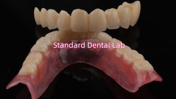 Highly Durable And Natural-Looking Layered Porcelain For Layered Dental Zirconia Crown China Dental Lab