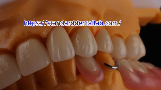 Layered Dental Zirconia Crown And Bridge Translucency 3D PRO Zirconia Porcelain Crown Standard Dental Lab