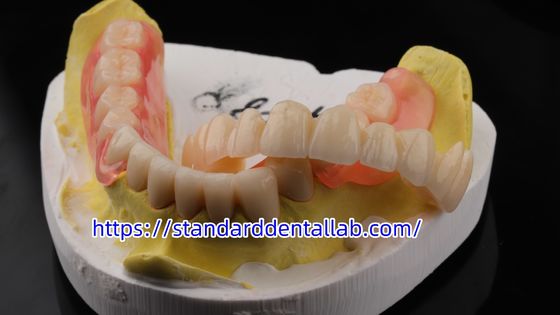 High Esthetics Dental TCS Valplast Flexible Partial Dentures Dental Lab Valplast Clasp Pink Shade
