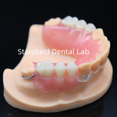 High Esthetics Acrylic Partial Denture With Clear Clasp And Acrylic Teeth China Dental Lab