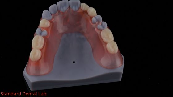 3D Print Model High Esthetics Dental TCS Valplast Flexible Partial Dentures Dental Lab