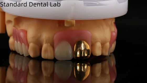 Full Acrylic Dentures With Yellow Gold Teeth/Dental Temporary Acrylic Denture Ivoclar Professional FDA Approved