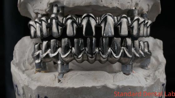 Dental Hybird Malo Implant Bridge Professional Perfect Fit FDA Certified