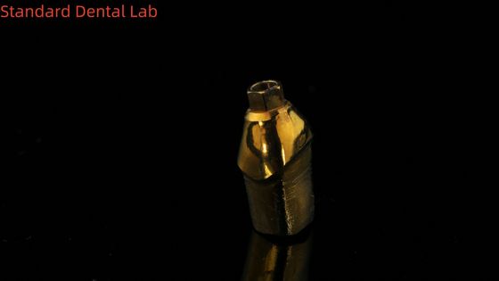 Pure Titanium Custom Abutments The Perfect Solution for Dental Restorations