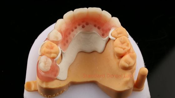 Peek Partial Framework Design ISO CE And FDA Dental Lab Acrylic Partial Denture Framework