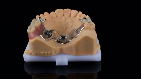Partial Cobalt Chrome Dentures Ivoclar Scheftner Comfortable Metal Framework Delivered in Just 3 Days