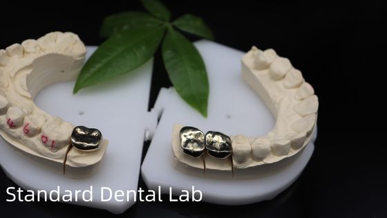 Professional ISO and FDA Approved Yellow Gold Crown for Dental Lab Shipping UPS Or Fedex Production Time 2 Days