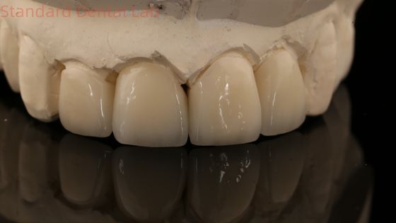 Strong Layered Zirconia Crown And Bridge In Good Esthetics Zirconia Layered China Dental Lab