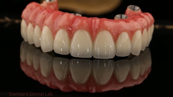 Full Arch Zirconia Implants Bridge Zirconia Crown Vita Shade Customized All On Four / Six Dental Implant