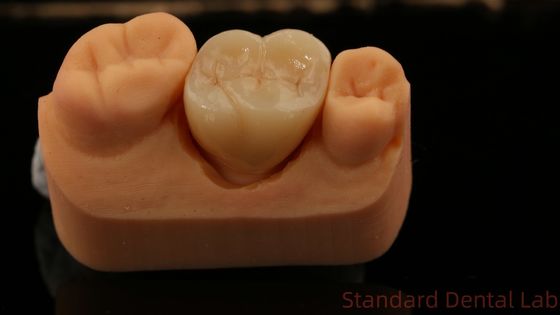 Mill and Centring Full Zirconia Crown , China Dental Lab Fast Delivery