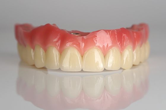 Full Arch Zirconia Implant Bridge All-On-Four / All On Six Dental Implants Fast Recovery