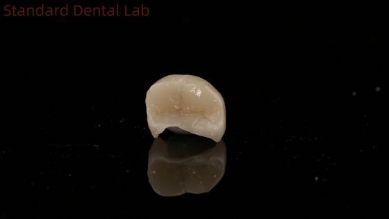 Translucency Dental Zirconia Crown Inlay Onlay Crown For Restore Natural Cavity Shape