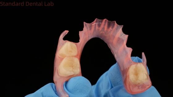 3D Print Model Dental TCS Valplast Flexible Partial Dentures Pink / Dark Color Dental Lab Product