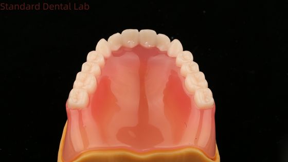 Complete Denture Ivoclar Full Denture Acrylic Teeth SDL Dental Lab