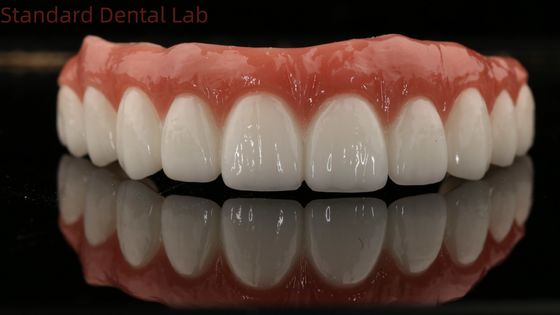 High Quality Dental zirconia crown and All On Four Six Implant Full Arch / China dental lab Manufacturer