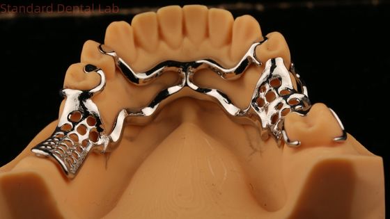 Upper Cast Metal Framework Partial Dentures Strong Lightweight And Durable