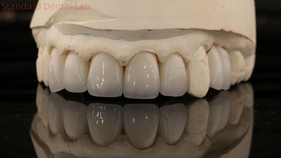 China Dental Lab Zirconia Full Contour Crown High Aesthetic Natural Dental Bridge 5 Year Guarantee