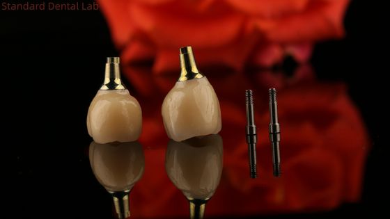 Porcelain Zirconia Cement Retained Screw Implant Hexagonal Head Shape for Custom Fit Esthetics