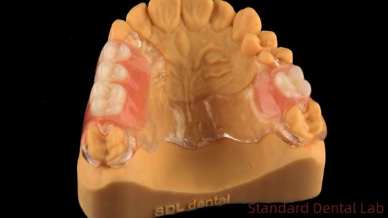 Flexible Clear Metal Cast Framework Partial Dentures High Esthetics Perfect Fit