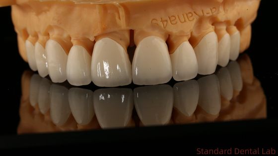 Full Contour Dental Lab Crowns High Translucency Solid Zirconia Crown China Dental Lab