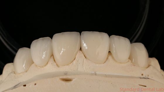 Precise Zirconia Crown Bridge Comfortable Fit / Esthetics 3-4 Days Quick Turnaround Time