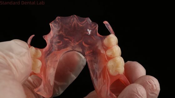 Ace Teeth Pink/Dark TCS Valplast Flexible Partial Dentures for High Esthetics Dental 3D Print Model