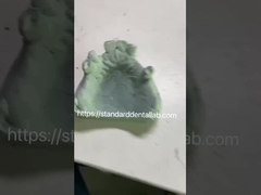 Fast and Cast Framework Co-Cr Metal Partial Denture Framework for Dental Professionals