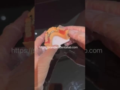 High Esthetics acrylic partial denture with clear clasp and acrylic teeth China Dental Lab