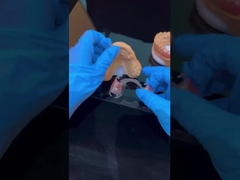 Clear framework Acrylic Metal Partial Denture Frameworks High Esthetics China dental lab