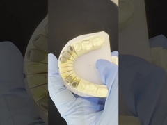 Metal Cast Post Core Crown Cocr Accurate Retentive Full Zirconia Bruxier