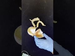 Dentsply Lucitone 199 Acrylic Denture for Full Arch Natural Look