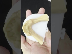 Metal Alloys Partial Cobalt Chrome Dentures Ivoclar Scheftner Comfortable Metal Framewrok