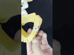 Porcelain All On Four Zirconia Bridge High Esthetics Dental Implant Bridge Screw Retained