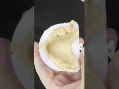 Metal Alloys Partial Cobalt Chrome Dentures Ivoclar Scheftner Comfortable Metal Framewrok