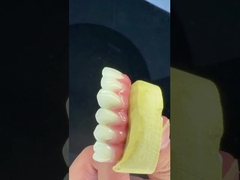 Dental Implant Crown