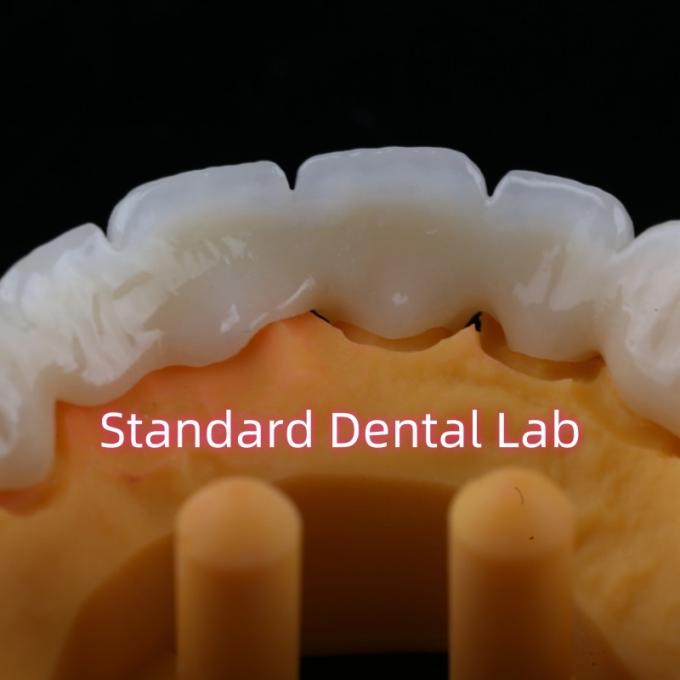 CAD CAM Mill Zirconia Crown Bridge Highly Biocompatible